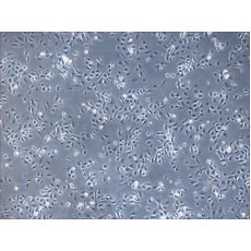Mouse Epidermal Keratinocytes -neonatal (MEK-n)